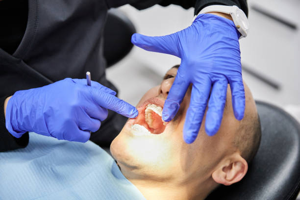 Emergency Treatment for Knocked-Out Teeth